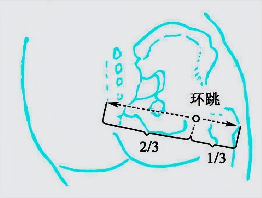 四个原因亚健康_亚健康5大原因_亚健康主要原因