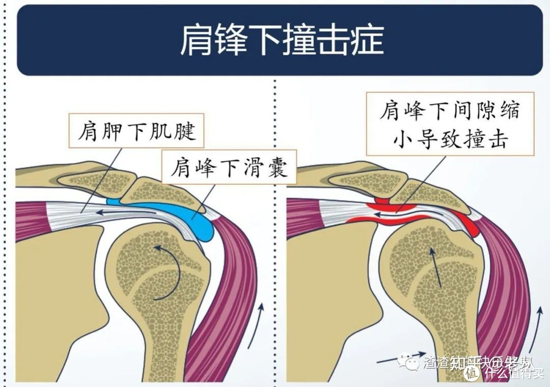 俯卧撑从0到1进阶教程+2大常见错误+3个强化训练动作