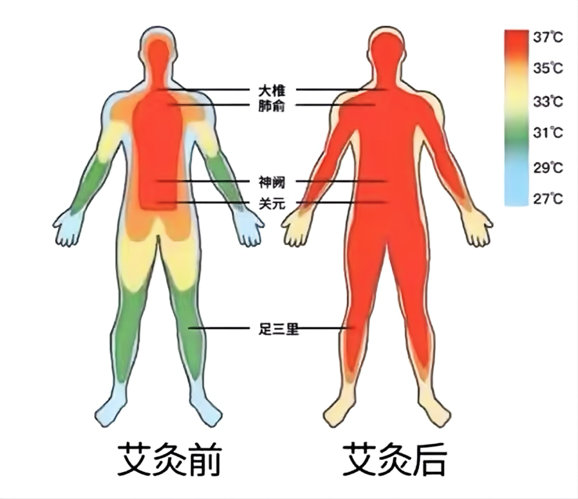 督脉灸健康宣教_艾灸督脉灸的作用和功能_亚健康督脉灸