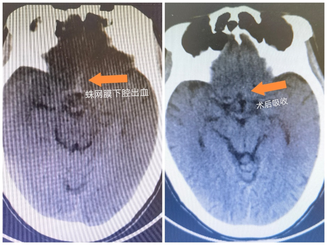 揭阳亚健康调理_揭阳亚健康调理_揭阳亚健康调理