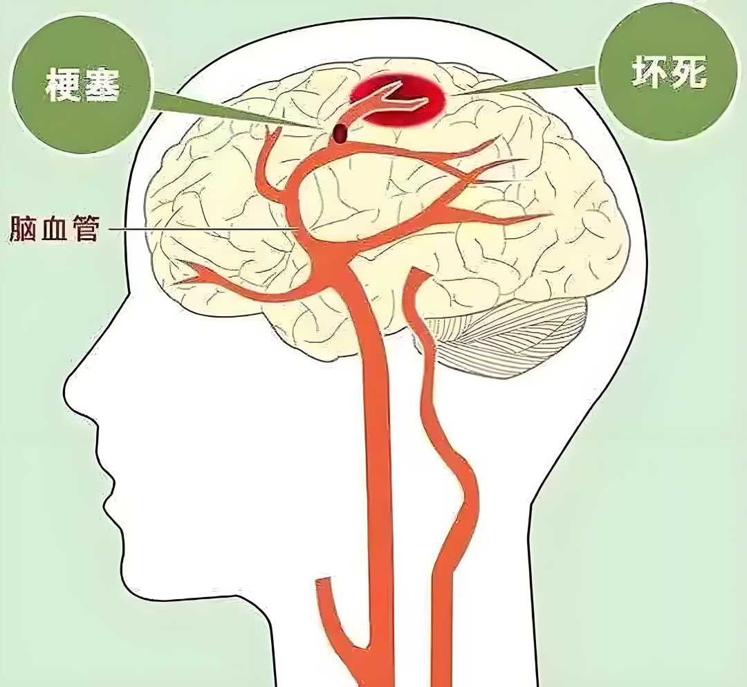 揭阳亚健康调理_揭阳亚健康调理_揭阳亚健康调理