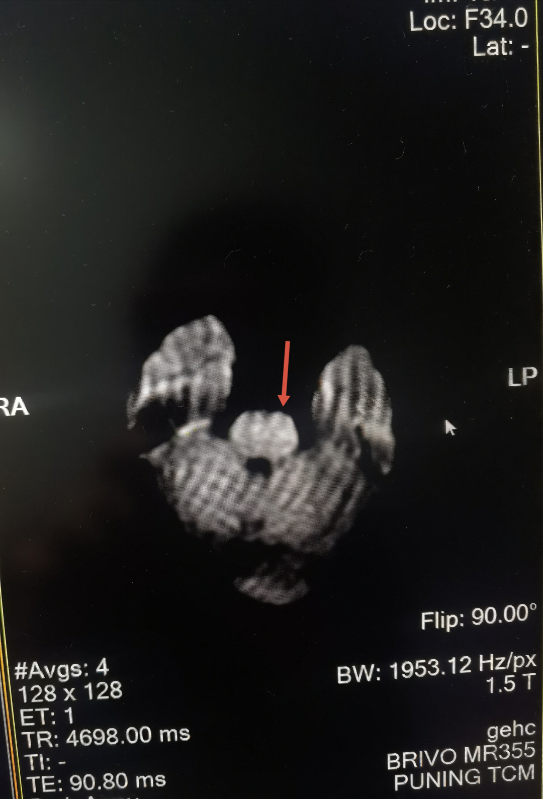 揭阳亚健康调理_揭阳亚健康调理_揭阳亚健康调理