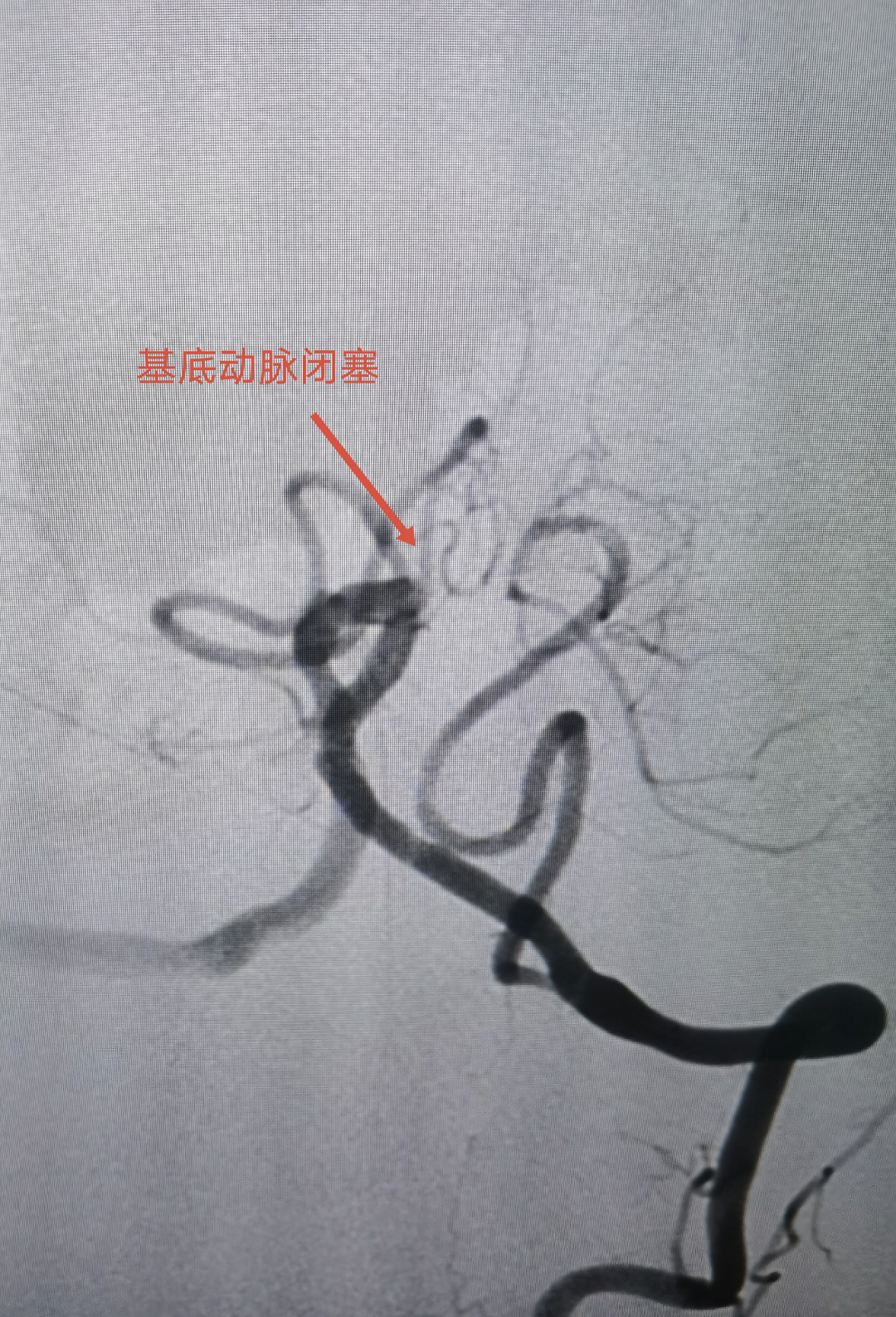 揭阳亚健康调理_揭阳亚健康调理_揭阳亚健康调理