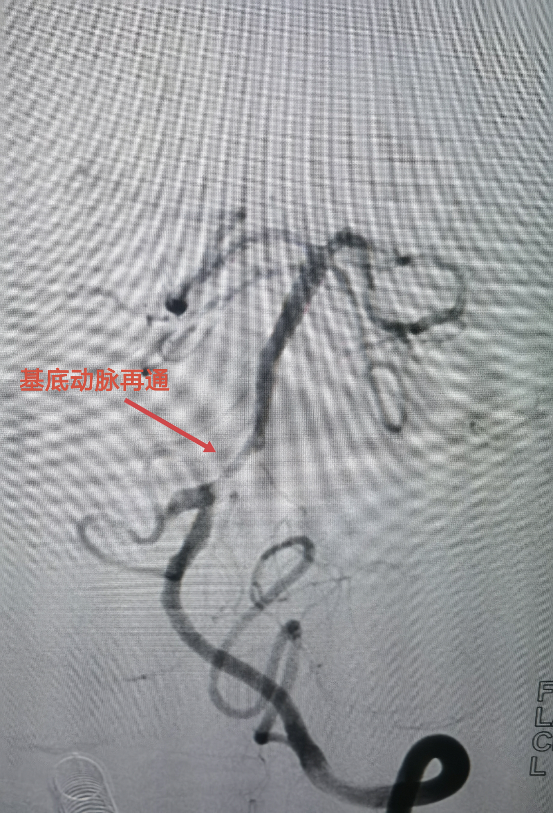 揭阳亚健康调理_揭阳亚健康调理_揭阳亚健康调理